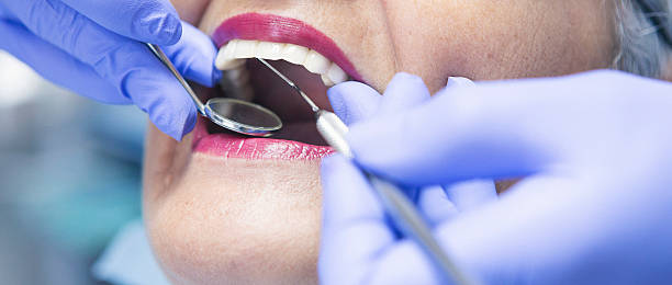 Best Emergency Cosmetic Dentistry (e.g., broken veneers) in Meridian Hills, IN